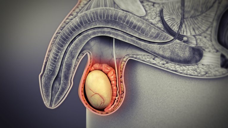 Men urged to examine testes at least once a month