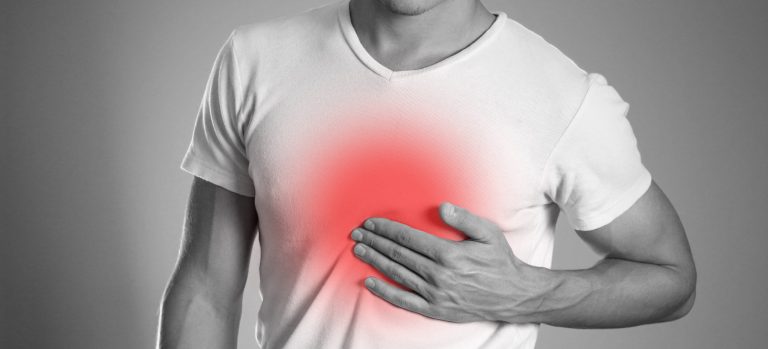Causes of Heartburn and Effective Prevention Strategies