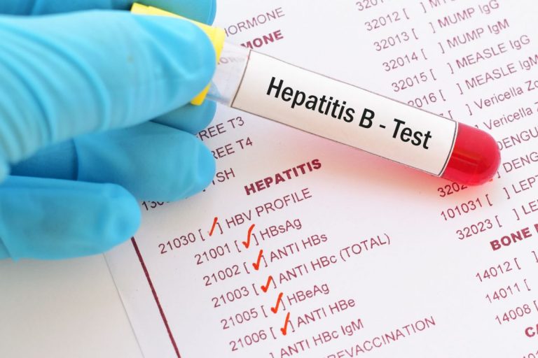 Hepatitis