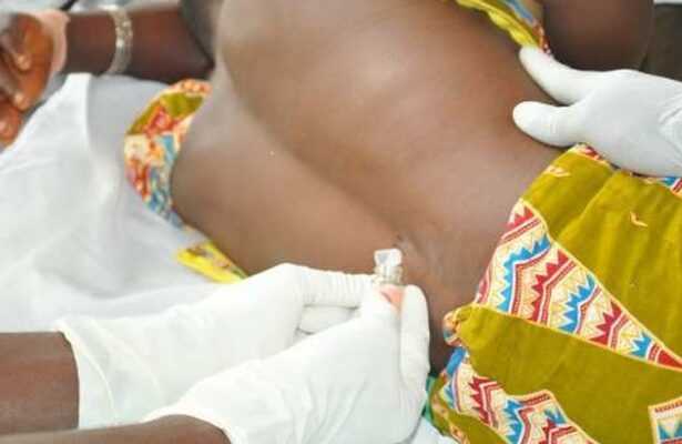 CSM: Upper West Region records 42 suspected cases and 10 deaths